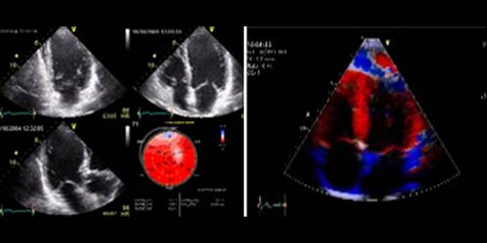 Top 2D Echo Test Service in Kharghar, Mumbai